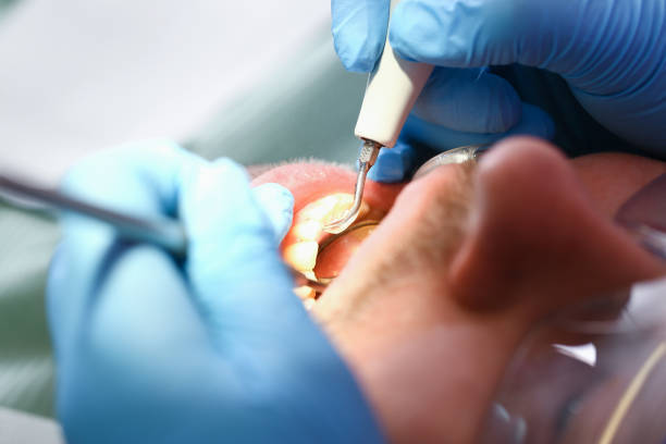 Best Emergency Dentist for Special Needs Patients in Lucas, TX