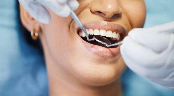 Best Emergency Dental Care for Abscessed Tooth in Lucas, TX